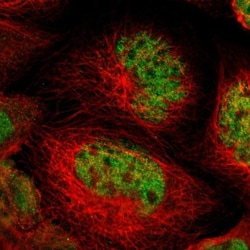 NFRKB Antibody, Novus Biologicals:Antibodies:Primary Antibodies
